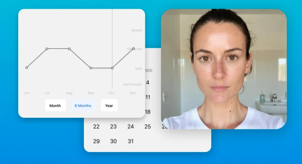 Clearist skin progress chart, calendar, and selfie
